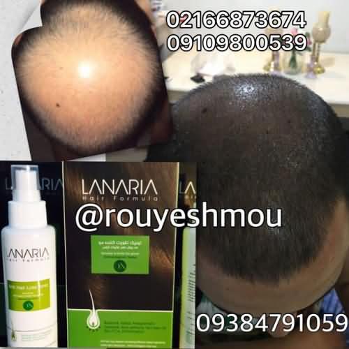 محلول دکتر نوروزیان